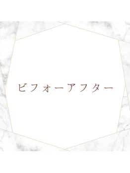 セルフダック 滋賀守山店(SELFDUCK)/ビフォーアフター写真