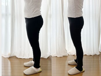 チョアラ(Choara)の写真/お腹周り・太もも・ヒップが気になる方必見！耳つぼ施術でメリハリボディをGET☆