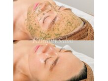 アールビューティーサロン(R Beauty Salon)の雰囲気（REVIハーブピーリングで肌質改善◎）