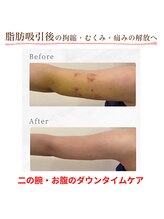 インディバ ホリ ナゴヤ ハニーズビューティー(INDIBA HORI NAGOYA Honey’s beauty)/名古屋インディバ