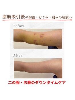インディバ ホリ ナゴヤ ハニーズビューティー(INDIBA HORI NAGOYA Honey’s beauty)/名古屋インディバ
