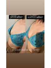 カシェット(cachette)/ミラクルバストプレミアム