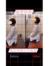ヒデ整体院(Hide整体院)/猫背・巻き肩矯正後＆骨盤矯正