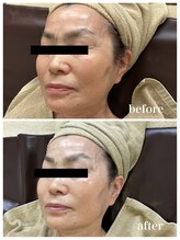 ジャスミン(Jasmin)/エステティック×シェービング