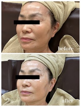 ジャスミン(Jasmin)/エステティック×シェービング