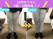 京都中丸整体カイロプラクティック/X脚