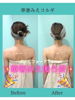 アコガレコガオ 鳥取店/コルギのビフォーアフター