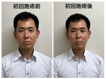 トータルバランス整体院 &nbsp;オレンジ(ORANGE)/小顔矯正/小顔整体/梅田/整体