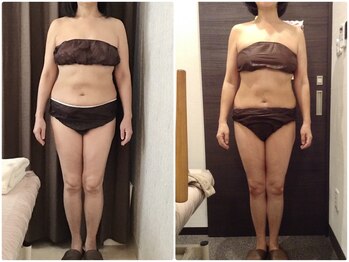 美容整体ウェリナ 名駅院/小顔矯正/骨盤矯正/美脚サロン