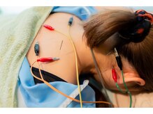 えんどう鍼灸接骨院の雰囲気（鍼灸もご対応◎【ストレートネック/巻き肩/自律神経】）