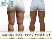 ヨサパーク ア モード ミオ 柴又店(YOSA PARK A modo mio)/浮腫みが取れてほっそり!