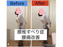 クレストかごしま ウェルネスストレッチ(Wellness Stretch)/腰椎のすべり