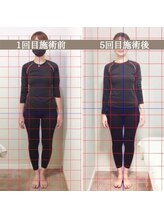 シェア 人形町店(Chare)/【小顔・骨盤矯正・О脚・整体】