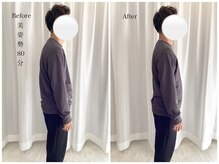 ワン ストレッチ(ONE stretch)/30代男性　before・after