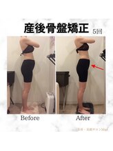 ミエル(Miel)/Before After