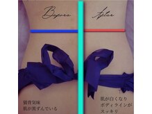 ハウオリ(Hauoli)/肩こり酷くてお悩みのお客様