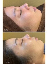 エムアイ 六本木(Mi)/