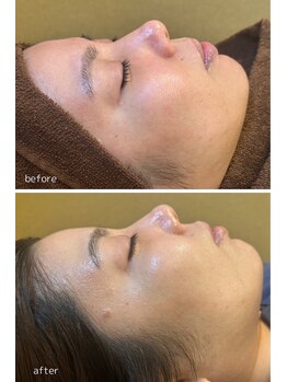 エムアイ 六本木(Mi)/