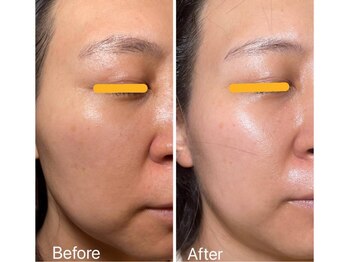 リュミエール デスポワール(Lumiere d'espoir)/白玉ピコ+プラズマ