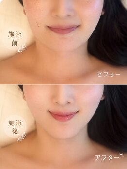 ドクターマジックタッチ(Dr.MAGIC TOUCH)/頬肉・二重あご撃退 /ほうれい線