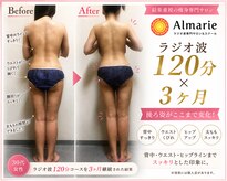 アロマリエ(al malie)