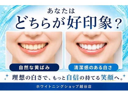 ホワイトニングショップ 越谷店の写真