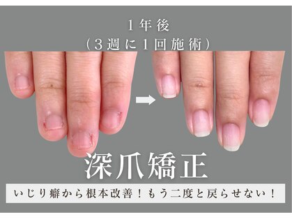 ヴェールリム(verl lim)の写真