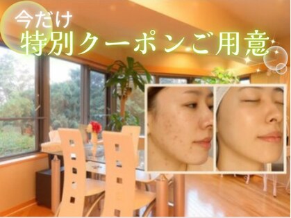 アンナビューティーサロン 博多店の写真