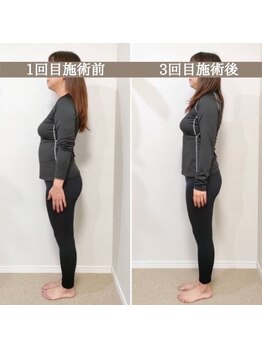シェア 人形町店(Chare)/【小顔・骨盤矯正・О脚・整体】