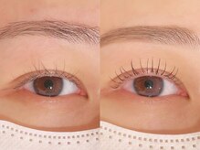 グラン アイ(GRAN EYE)/Before After