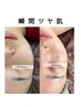 【人気No1】 本格肌質改善★REVIハーブピーリング120分¥11000→ ¥5500