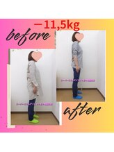 スーパースリムダイエット茅ヶ崎 茅ヶ崎整体院/3ヵ月－11,5ｋｇ減ダイエット♪