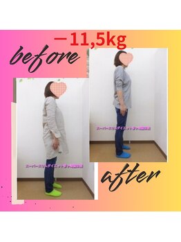 スーパースリムダイエット茅ヶ崎 茅ヶ崎整体院/3ヵ月－11,5ｋｇ減ダイエット♪