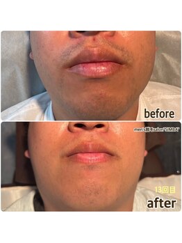 シンバ 倉敷店(SIMBA)/