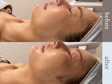 ビューティースタジオ韓美 渋谷店/お客様のbefore/after