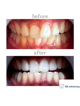 エヌエーホワイトニング たまプラーザ店(NAホワイトニング)/セルフホワイトニング