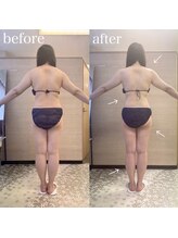 エステティックサロン アール 大阪梅田(esthetic salon R)/20代女性　後