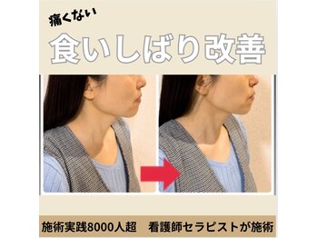 顔凛(カオリン)/食いしばり改善小顔矯正