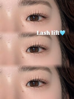 リンネ(LinNe)/KURUMI担当