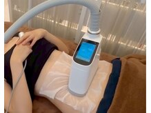ビーサロン(B-salon)/脂肪冷却の施術中の様子