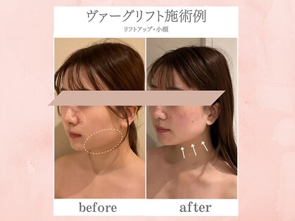 ラボーテアッシュ(La beaute H)の写真