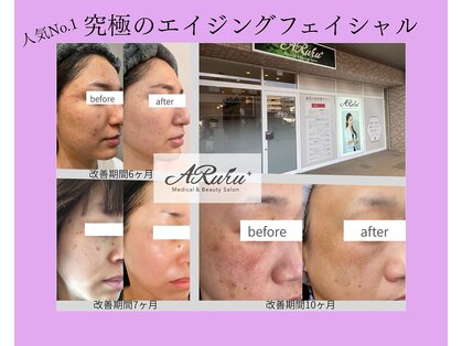 アルルプラス 南草津(ARuru+)の写真