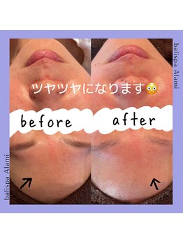 バリスパアラミー(balispa Alami)/before→after