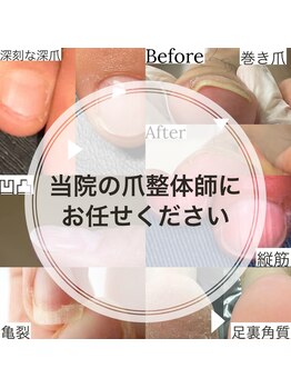 ヒューマン鍼灸接骨院/日本初の爪整体在籍接骨院◎
