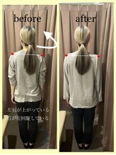 アイリー(Irie)/骨格矯正