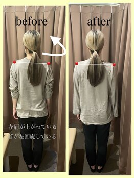 アイリー(Irie)/骨格矯正