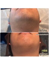 シンバ 倉敷店(SIMBA)/