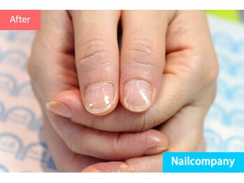 ネイルカンパニー/