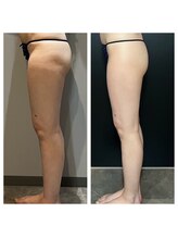 キュール(KuhL)/手ごわい下半身もスッキリ！