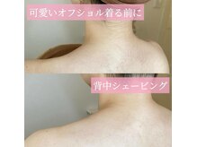 リンド エステ まつげ 京成大久保(Lind)/背中シェービング